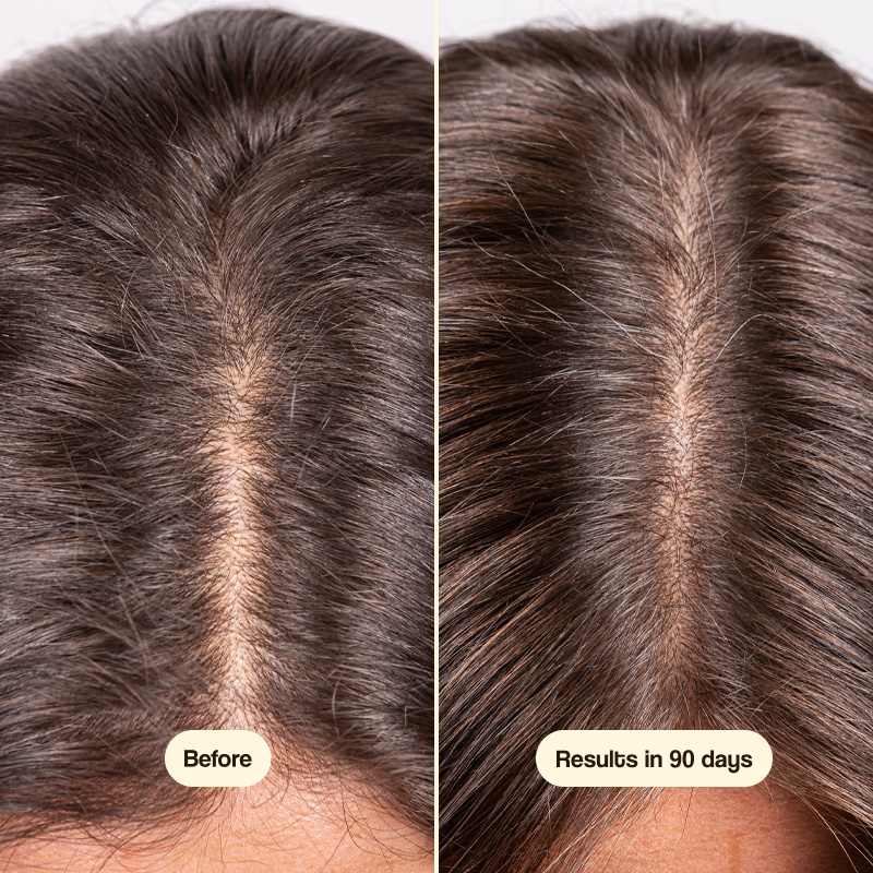 HAIR GROWTH 2x1 (240CAP)
